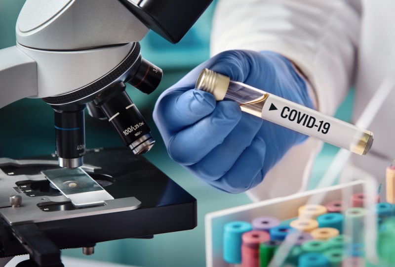 Coronavirus Research Index Reveals which Countries Put the most Effort in COVID-19 Research
