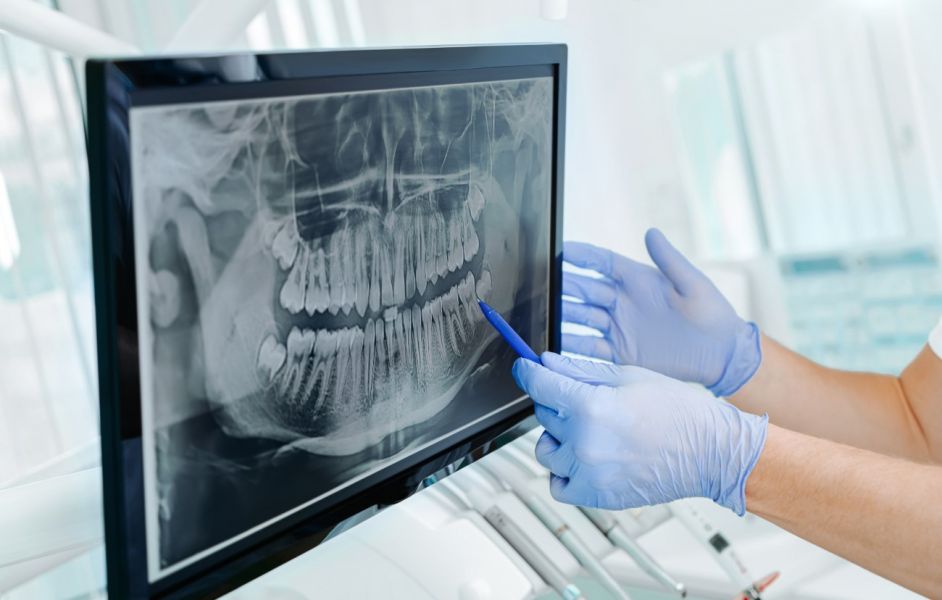 Dentyści żalą się, że procedury medyczne są na granicy opłacalności. Nie chcą pracować dla NFZ-u